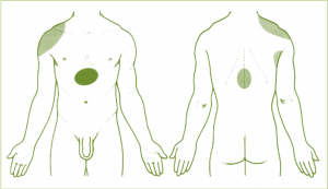fisioterapeuta madrid