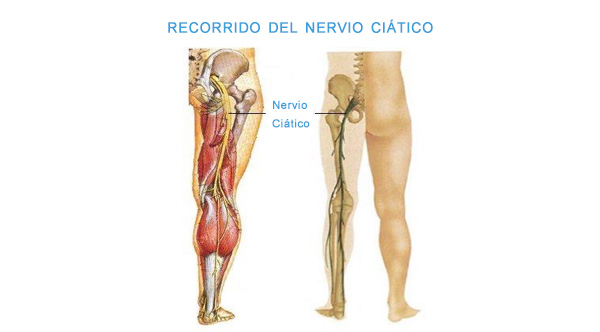 Recorrido del nervio Ciático