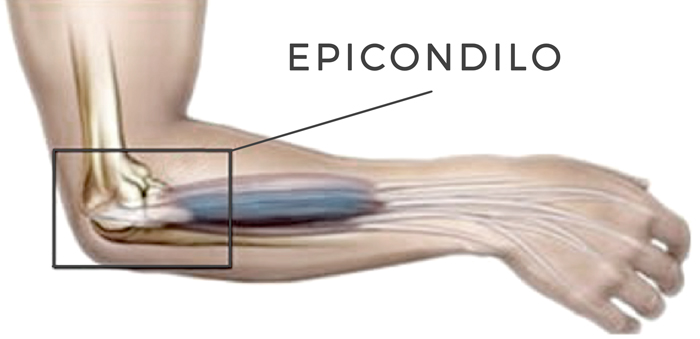 Epicodilo