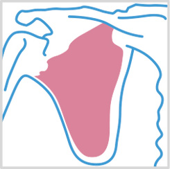 Subescapular - Manguitos Rotadores