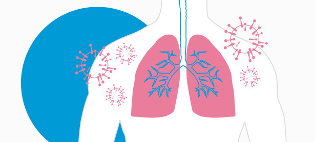 Fisioterapeuta tras Covid-19