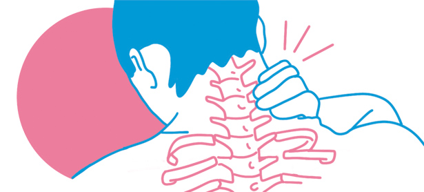 Síntomas de una Hernia Cervical