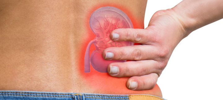 Dolor de espalda, depresión y fascitis plantar: descubre si tus riñones están afectados - Fisioterapia Goya